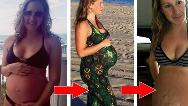 Cette femme poste des photos choquantes de son ventre juste après l'accouchement