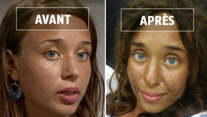 Perdue dans la forêt, cette jeune femme est retrouvée après 30 jours de survie