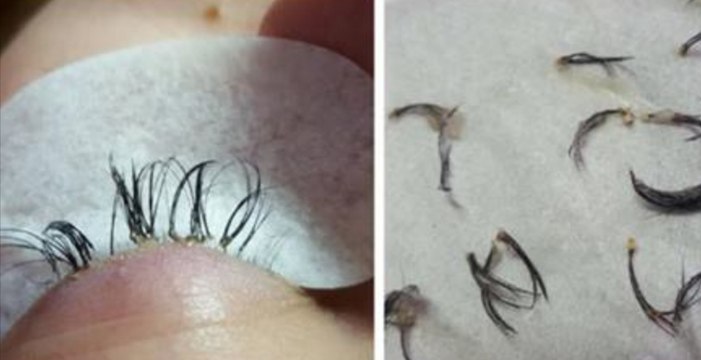 L'esthéticienne lui enlève ses extensions de cils mais elle découvre que ceux-ci sont en train de tomber