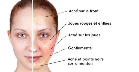 4 familles d'aliments qui font que vous avez du mal à avoir bonne mine