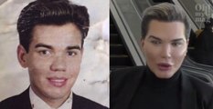 Rodrigo Alves: l'homme Ken est loin d'en avoir terminé avec la chirurgie... Il veut encore radicalement changer !