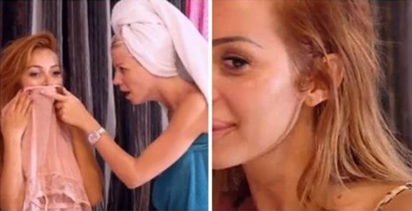 Les Marseillais VS Le reste du monde: Fidji amochée à la lèvre : piqûre d'araignée ou chirurgie ? Les internautes ont leur petite idée