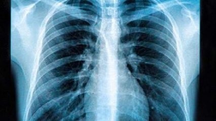 Il pensait avoir un cancer mais ce qu'il découvre est surprenant