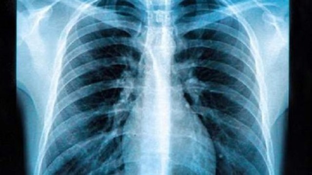 Il pensait avoir un cancer mais ce qu'il découvre est surprenant