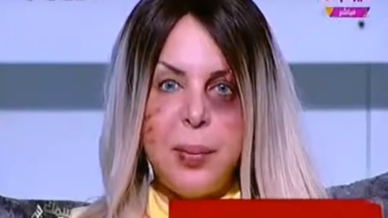 Une présentatrice égyptienne apparaît à l'écran  le visage tuméfié pour dénoncer les violences conjugales
