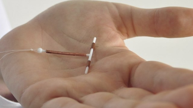 Stérilet : une protection contre le cancer du col de l'utérus