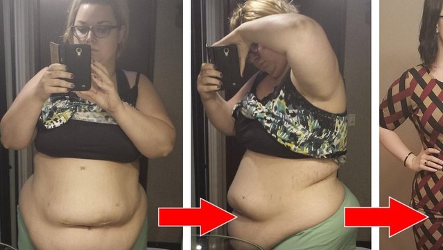 Cette femme de 141kg en perd 55... mais elle déteste son nouveau corps !