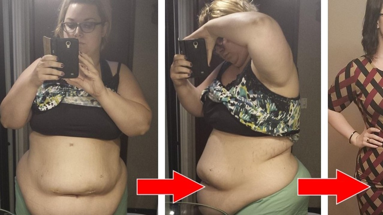 Cette femme de 141kg en perd 55... mais elle déteste son nouveau corps !