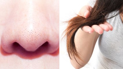 Dites adieu aux points noirs et hydratez vos cheveux avec le même ingrédient