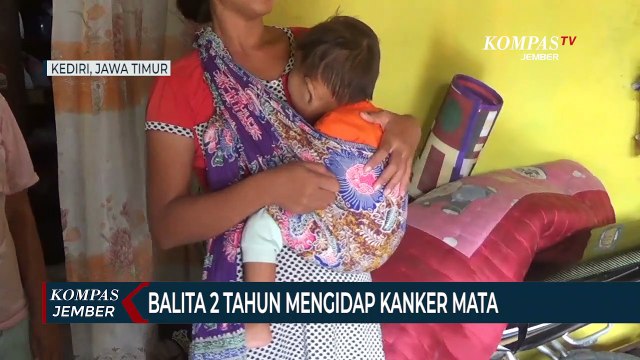 Balita Tak Bisa Melihat Karena Mengidap Kanker Mata