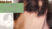 How to Treat Dandruff at Home || The real Cause of Dandruff || Five Easy ways to Get Rid of It