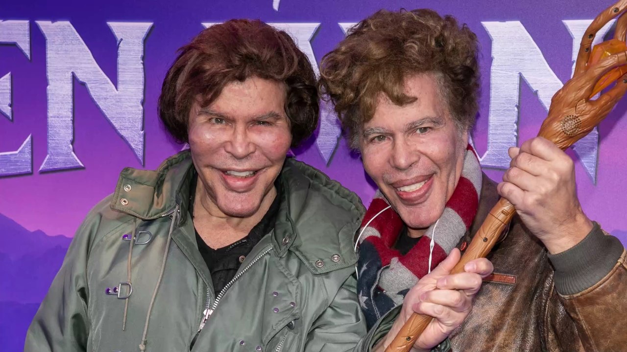 Igor et Grichka Bogdanoff : leur transformation physique expliquée