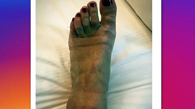 Festival de Cannes : Romane Bohringer dévoile l'état de ses pieds après la montée des marches