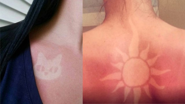 Les tatouages coup de soleil , une nouvelle tendance dangereuse
