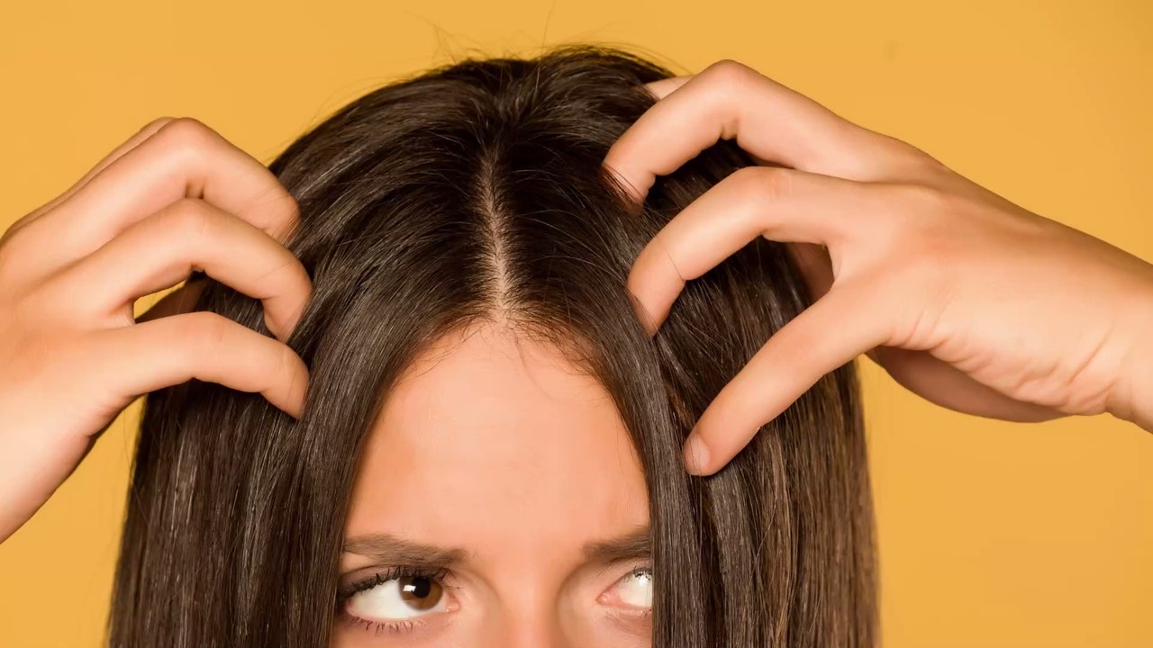 Pellicules : tout ce qu'il ne faut pas faire si vous en avez
