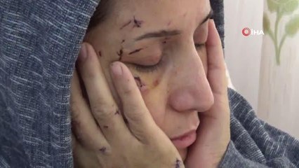 Yeğeni elini öpmedi diye dövdü, sonra da yengesini 50 yerinden bıçakladı