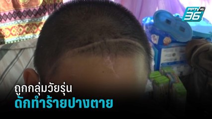 หนุ่ม16ปีถูกกลุ่มวัยรุ่นดักทำร้ายปางตาย | เข้มข่าวค่ำ