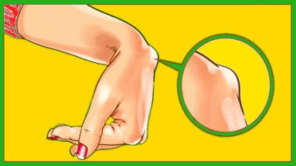 This Lump On Your Wrist Could Be A Sign Of Hygroma
