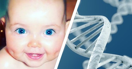This Precious Baby Has A Genetic Mutation, Can You Tell What It Is?