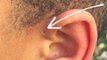 This Is The Real Reason Some People Have This Hole At The Top Of Their Ear