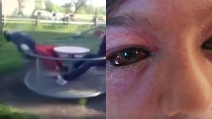 This Mum Is Issuing A Stark Warning To Parents After A Youtube Challenge Left Her Son In A Deadly Condition