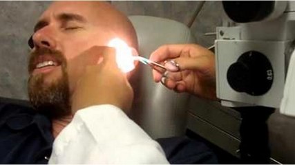 His Doctor Pulled This Huge Monstrosity From His Ear