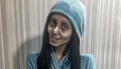 After Deceiving Instagram, The ‘Fake Angelina Jolie’ Reveals Her True Face