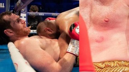 Boxer Kash Ali Disqualified After Totally Losing It And BITING David Price