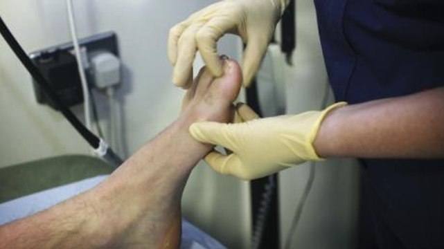 After Complaining About A Pain In His Foot, This Man Discovered He Was Suffering From A Rare Condition