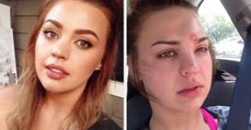 This Woman Almost Died Because She Didn't Wash Her Makeup Brushes
