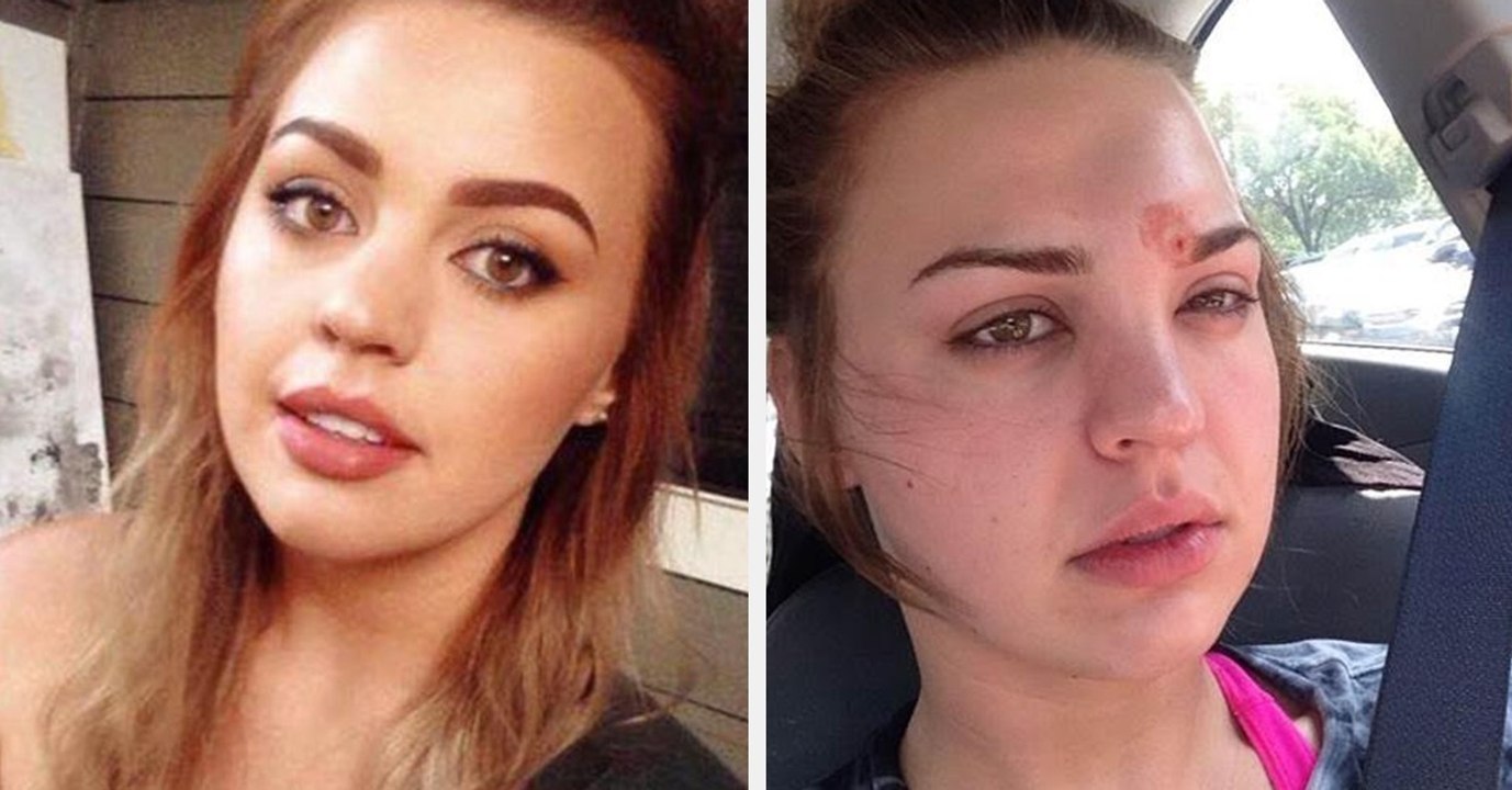 This Woman Almost Died Because She Didn't Wash Her Makeup Brushes