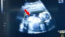 She Went To The Doctors For The First Time At 41 Weeks Pregnant - And Discovered Something Shocking