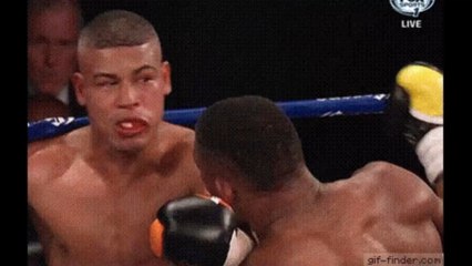 Boxer Cheyenne Hanson reveals images of her completely mangled face