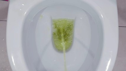 Man lived two years peeing through the anus and farting through the penis