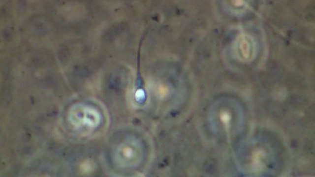 6 signs your semen is healthy and strong