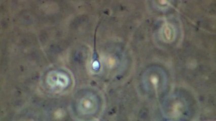 6 signs your semen is healthy and strong