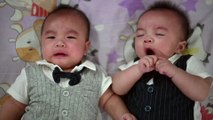 Baby born with parasitic ‘headless’ twin attached to its back