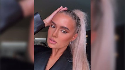 Love Islander Molly Mae Reveals Photos of Large Strawberry Birthmark