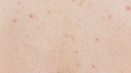 The 7 best acne body washes of 2021