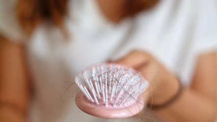 Hair loss: Avoid these foods to stop losing hair