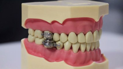 New magnetic weight loss device could be the solution to end obesity