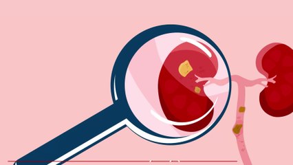 Elle fait don d'un rein à son petit ami, ce qu'il lui fait après est horrible