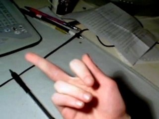 My middle finger is hurt so much PAIN