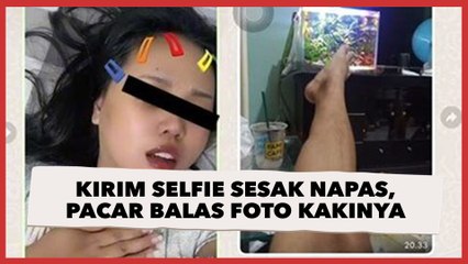 Cewek Kirim Selfie Sesak Napas, Pacar Balas Pakai Foto Kakinya: Lemak Diserap Ayang