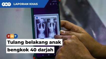 Tulang belakang anak bengkok 40 darjah, ayah kesal ramai pelajar ‘mangsa’ beg sekolah berat