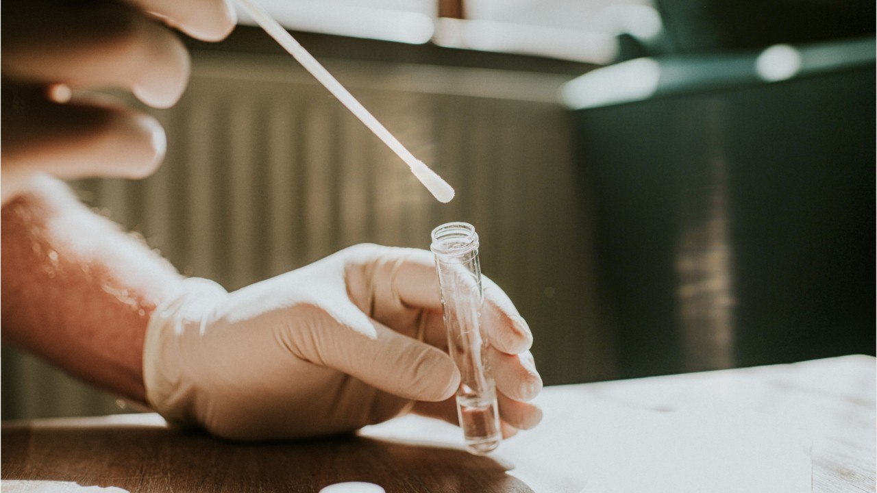 Testé positif au Covid 78 fois, il est isolé depuis 14 mois