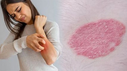 शरीर पर ऐसी खुजली होना जानलेवा Cancer ke Symptoms, जाने कारण और बचाव | Boldsky
