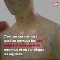 CAM - Tout savoir sur l'acupuncture.