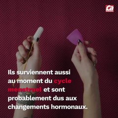 CAM - Pourquoi a-t-on des aphtes ?