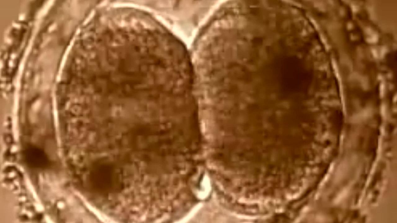 Quel est le seul organe capable de se régénérer tout seul ?